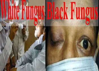 Black Fungus White Fungus