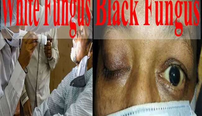 Black Fungus White Fungus