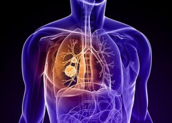 Lungs Problem