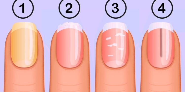 Nail Colour
