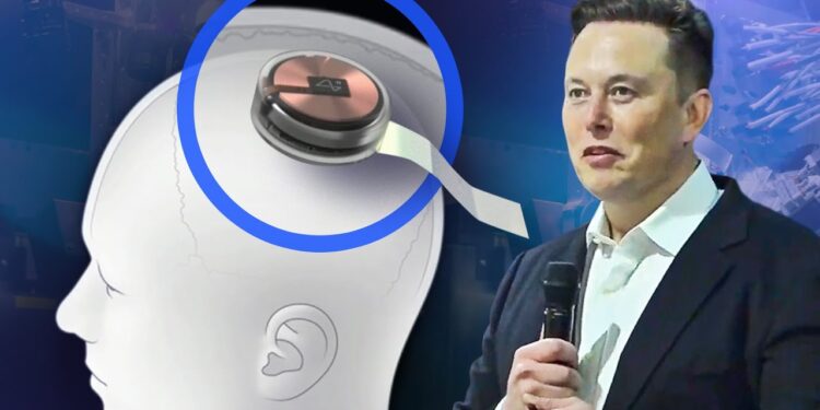Neuralink